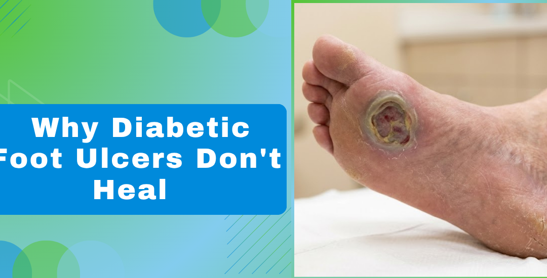 Why Diabetic Foot Ulcers Dont Heal