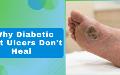 Why diabetic foot ulcers don’t heal on their own, and what a plastic surgeon can do?
