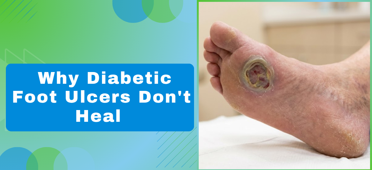 Why Diabetic Foot Ulcers Dont Heal