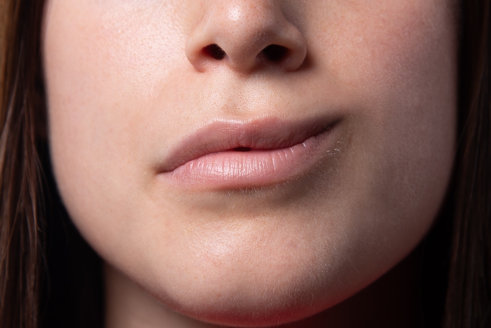 Close-upOfTheMouthOfAGirlWithHemiparesisBells - Dr Leena Jain Close-up of a woman's lips and lower face with smooth skin.