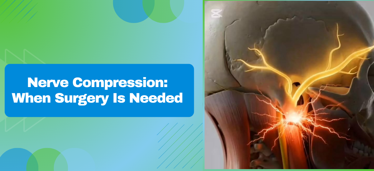 What Is Nerve Compression and When Does It Need Surgery?
