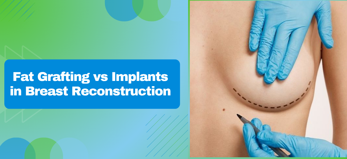 Can Fat Grafting Replace Implants in Breast Reconstruction?