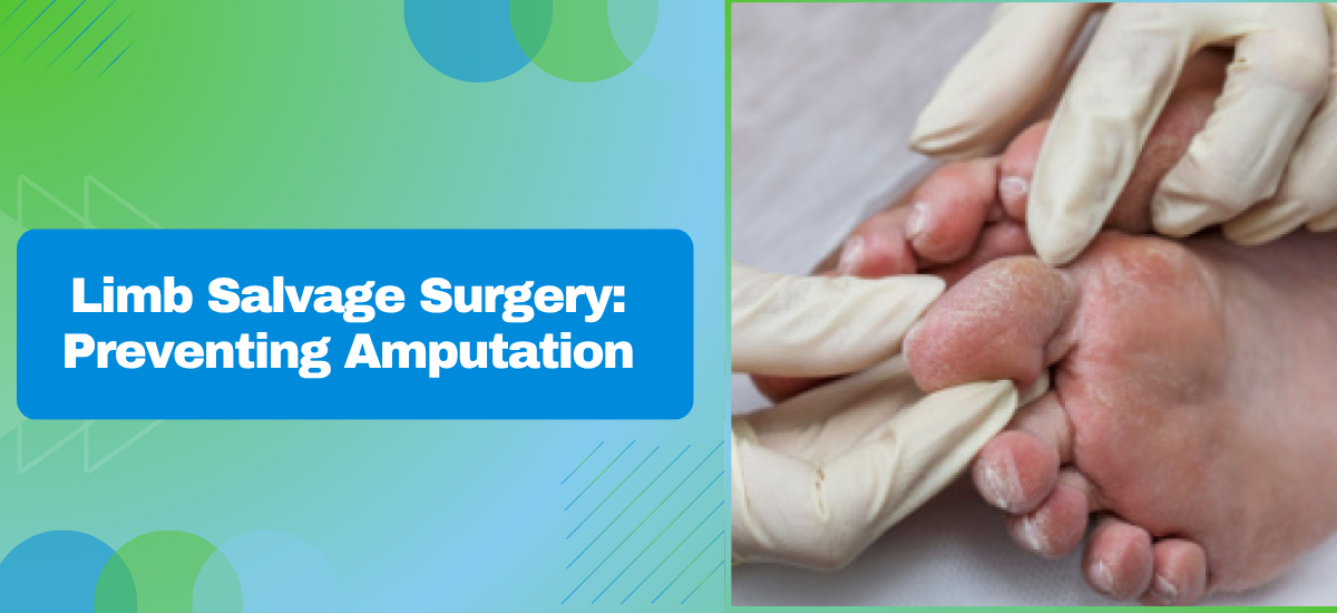 How Does Limb Salvage Surgery Prevent Amputation?