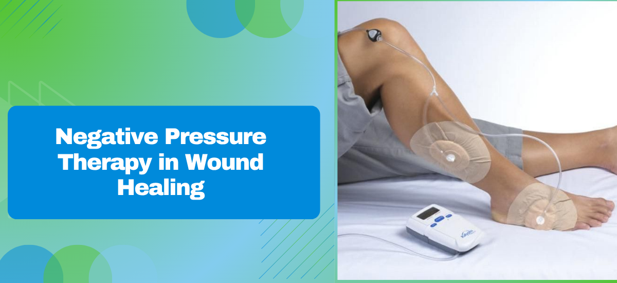 What Is the Role of Negative Pressure Therapy in Wound Healing?