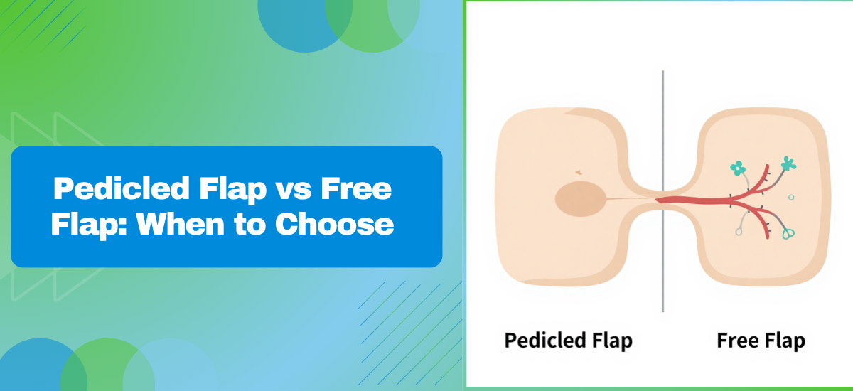 What Is a Pedicled Flap and When Is It Preferred Over a Free Flap?