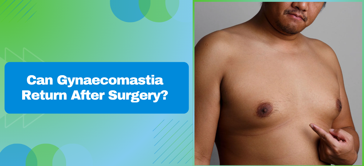 Can Gynaecomastia Return After Surgery?