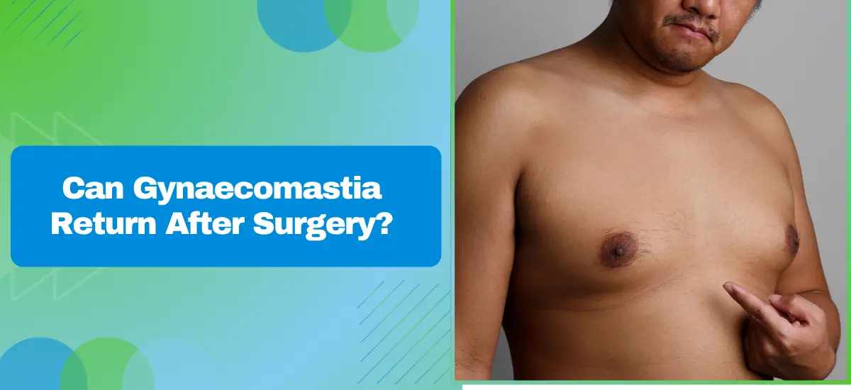 Can Gynaecomastia Return After Surgery