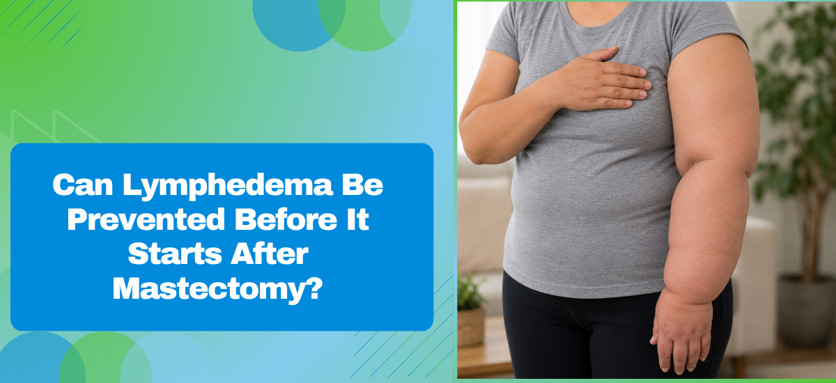 Can Lymphedema Be Prevented Before It Starts After Mastectomy