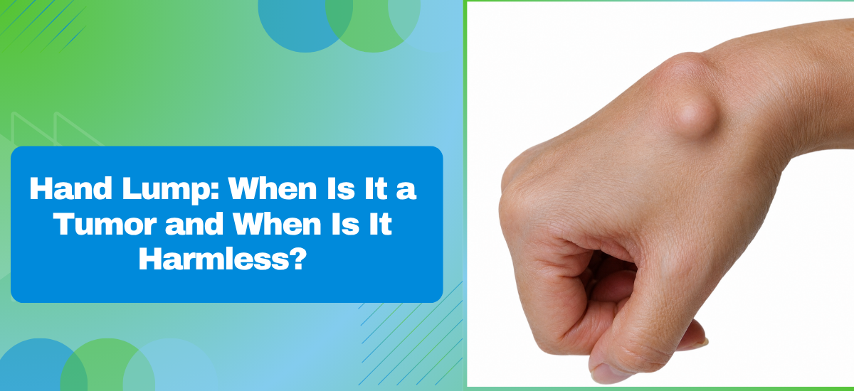 Hand Lump: When Is It a Tumor and When Is It Harmless?