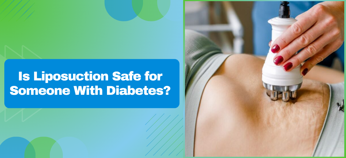 Is Liposuction Safe for Someone With Diabetes?