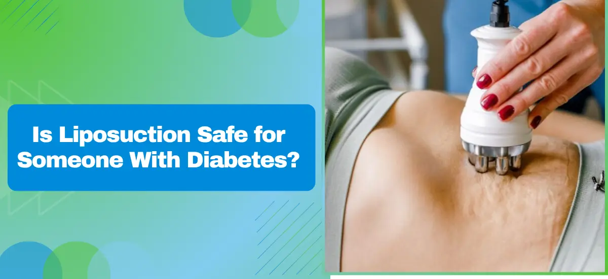 Is Liposuction Safe for Someone With Diabetes?