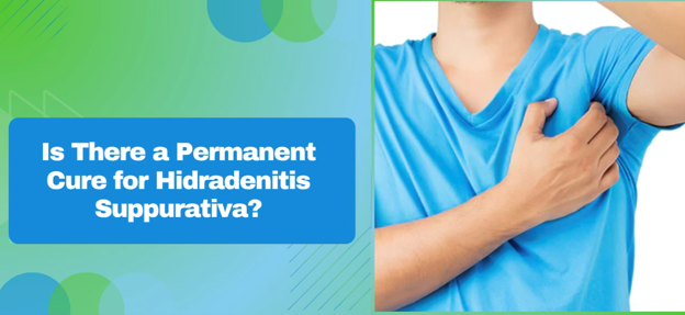 Is There a Permanent Cure for Hidradenitis Suppurativa?