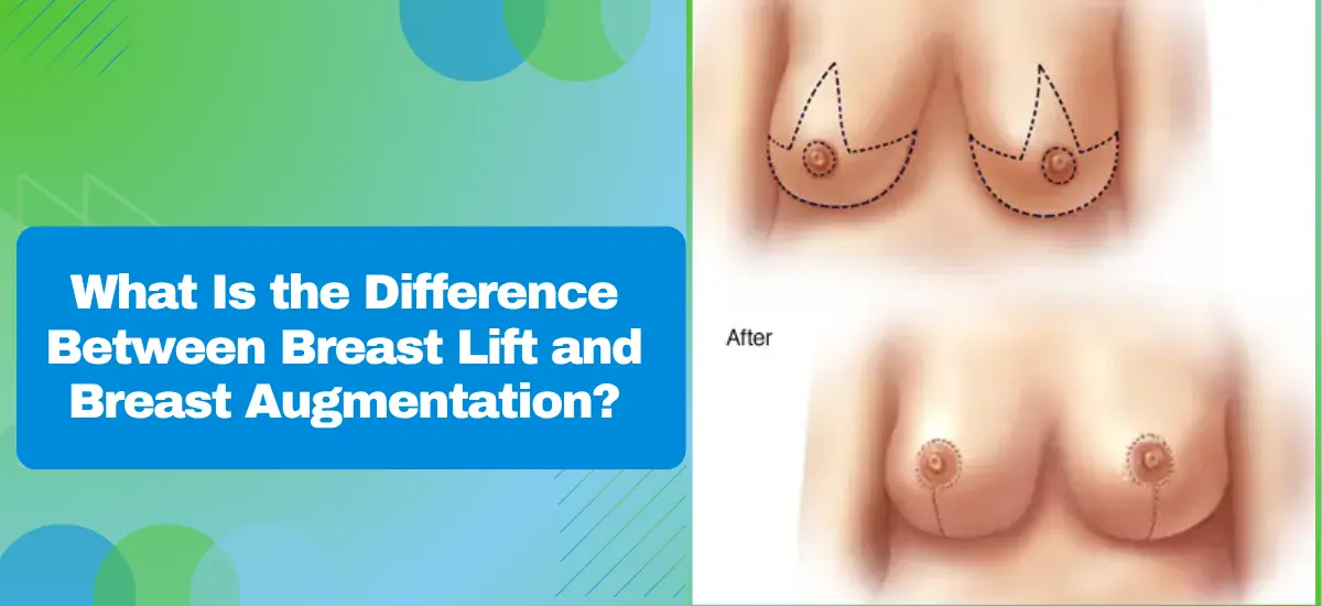 What Is the Difference Between Breast Lift and Breast Augmentation
