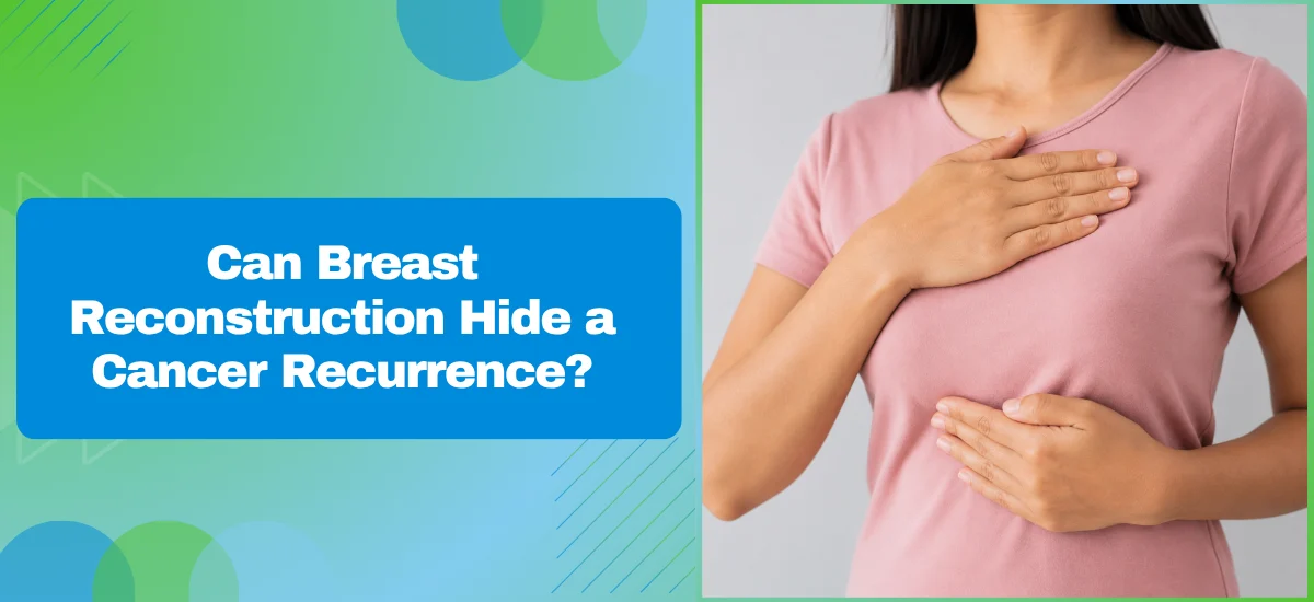 Can Breast Reconstruction Hide a Cancer Recurrence?
