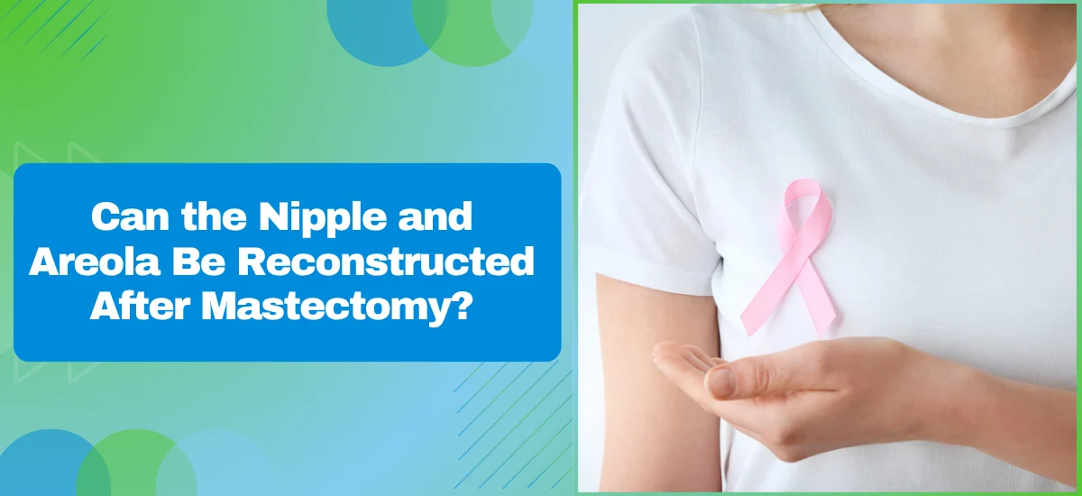 Can the Nipple and Areola Be Reconstructed After Mastectomy?