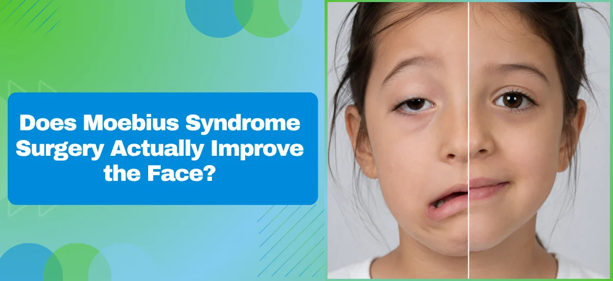 Does Moebius Syndrome Surgery Actually Improve the Face?