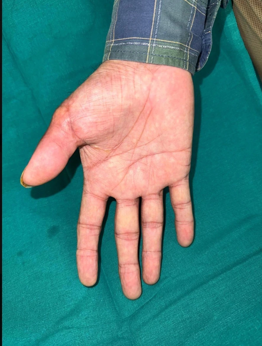Left hand open with palm facing up, resting on teal fabric; cuff of a plaid shirt sleeve is visible.