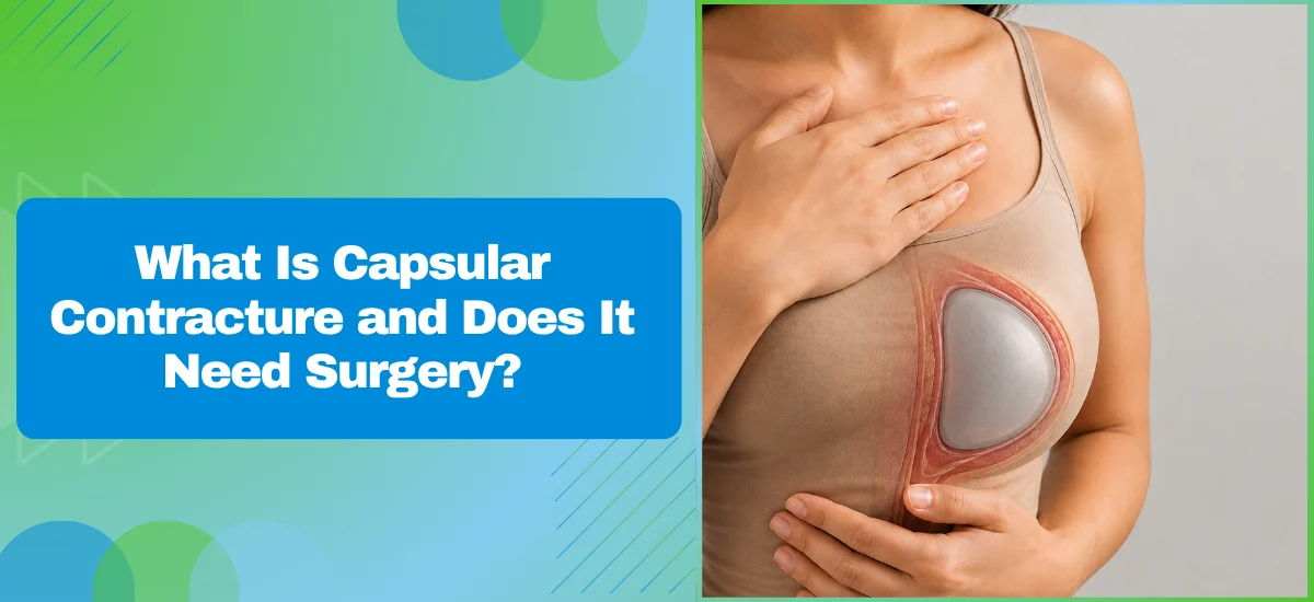 What Is Capsular Contracture and Does It Need Surgery