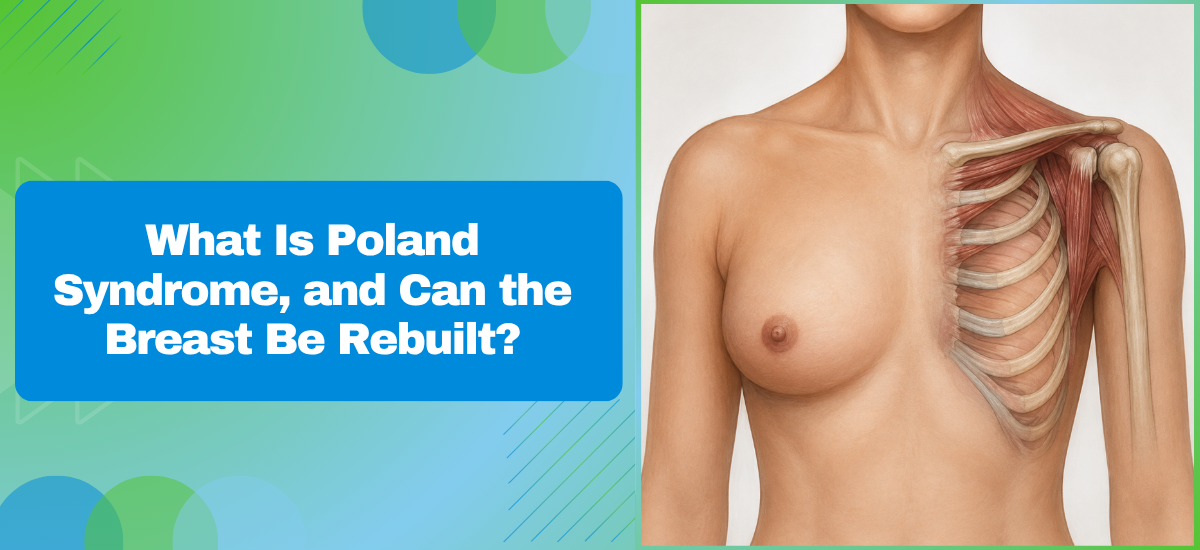 What Is Poland Syndrome and Can the Breast Be Rebuilt