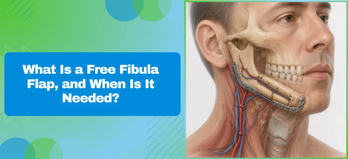 What Is a Free Fibula Flap and When Is It Needed