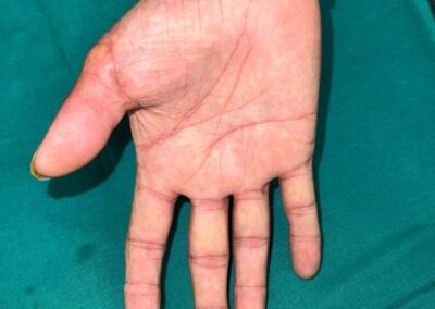 Open left hand with palm up, visible palm lines, wearing a plaid shirt sleeve against a teal background.