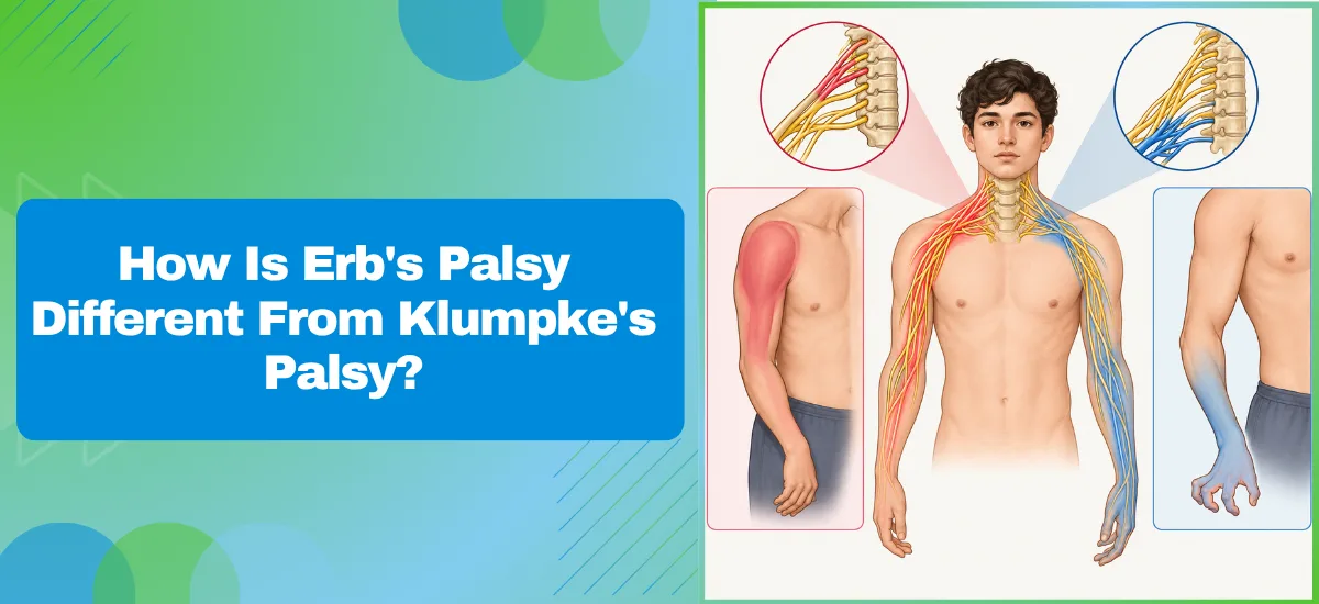 How Is Erb’s Palsy Different From Klumpke’s Palsy?