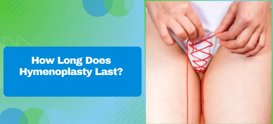 How Long Does Hymenoplasty Last?