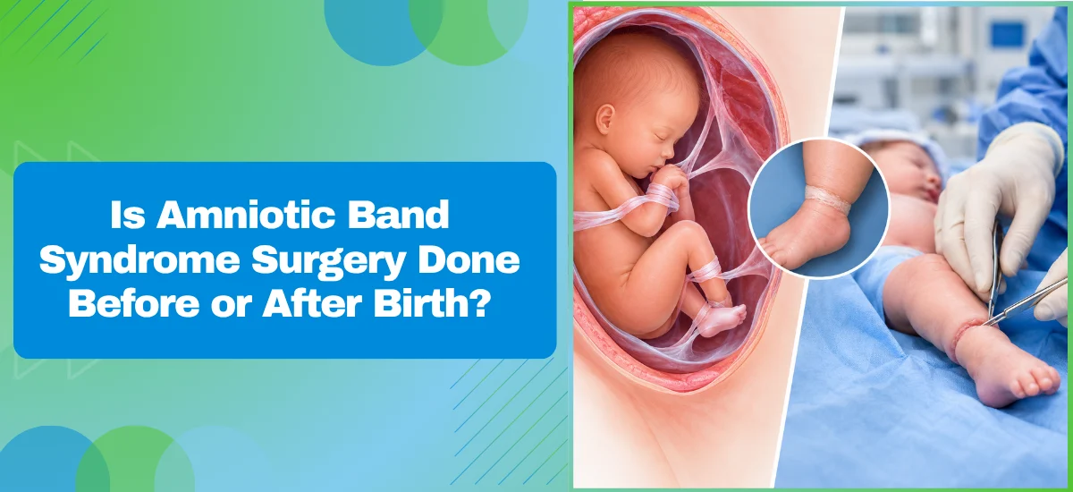 Is Amniotic Band Syndrome Surgery Done Before or After Birth?