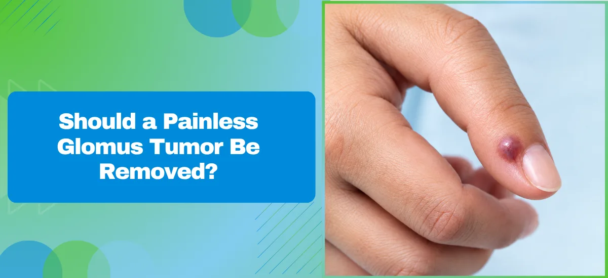 Should a Painless Glomus Tumor Be Removed?