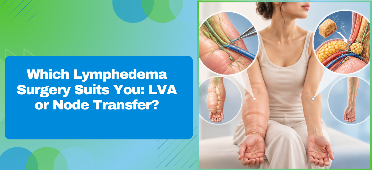 Which Lymphedema Surgery Suits You: LVA or Node Transfer?