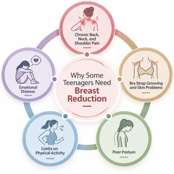 Breast Reduction in Teenagers Picture 2 - Dr Leena Jain Infographic showing five reasons for teen breast reduction around a central title: chronic back/neck/shoulder pain, bra-strap grooving, skin problems, poor posture, limits on physical activity, and emotional distress.