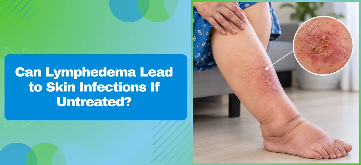 When Is a Lymph Node Transfer the Right Lymphedema Fix?