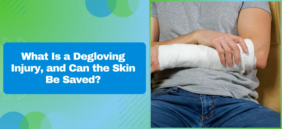 Informational graphic about degloving injuries with the title text on a blue card and a forearm wrapped in bandages on the right.
