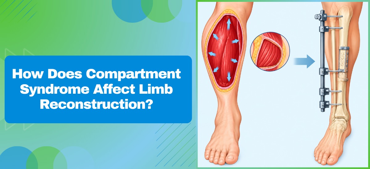 How Does Compartment Syndrome Affect Limb Reconstruction?